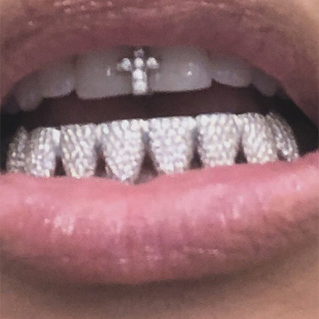 130749 Ким Кардашьян украсила зубы бриллиантами
